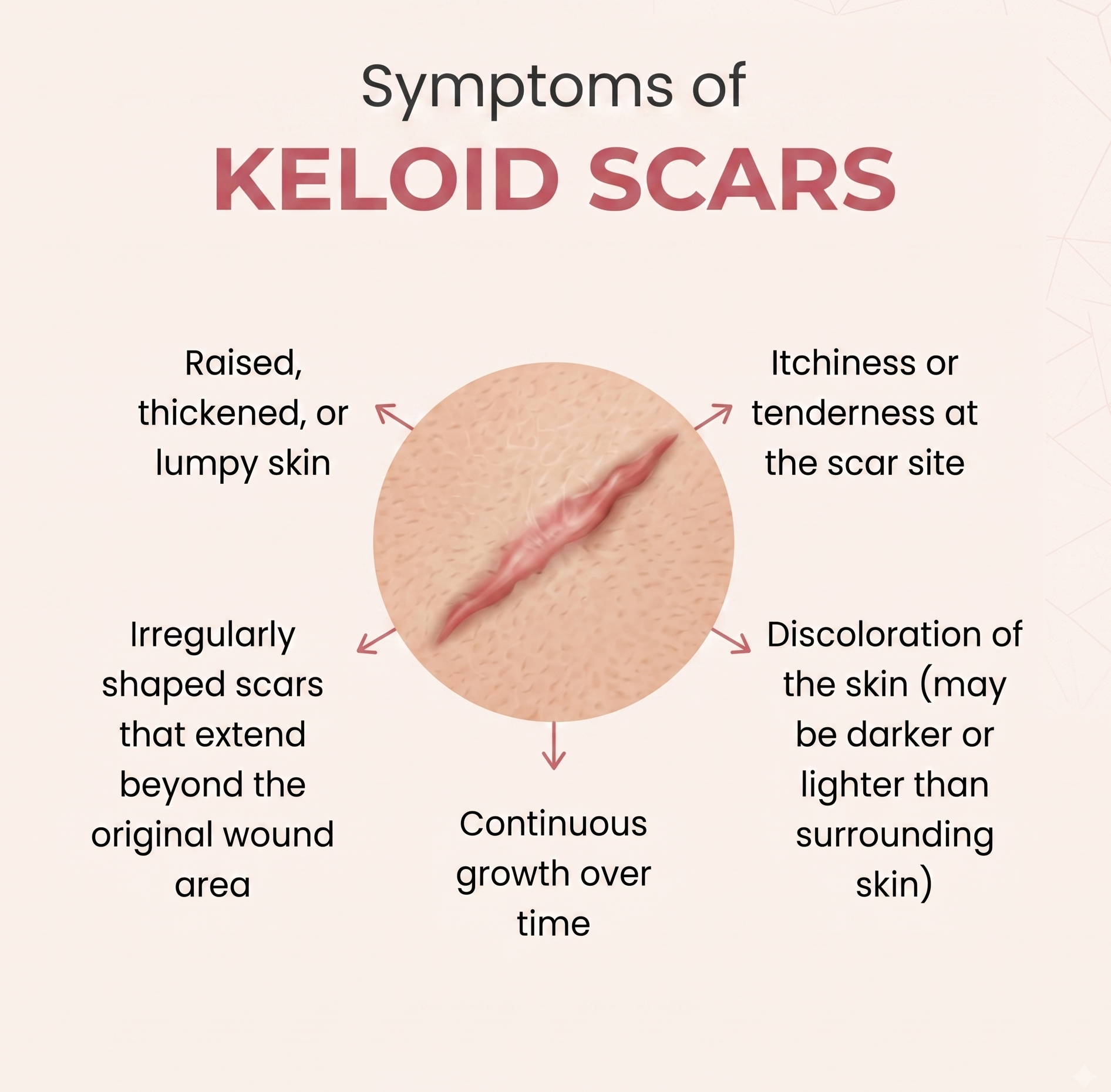 Dr. Alex KimDr. Alex Kim | Beverly Hills Plastic Surgeon, MD| Beverly Hills Plastic Surgeon, MD Dealing with a Stubborn Scar? Here is Why Keloids Form and How to Treat Them 1 Dr. Alex KimDr. Alex Kim | Beverly Hills Plastic Surgeon, MD| Beverly Hills Plastic Surgeon, MD keloid scar treatment los angeles beverly hills california
